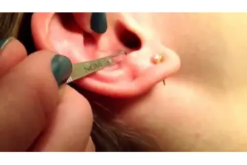 Kulak İçinde Siyah Nokta