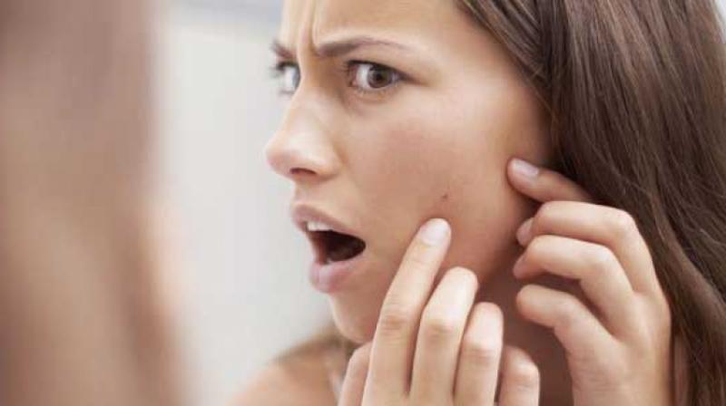 Evde Siyah Nokta Maskesi